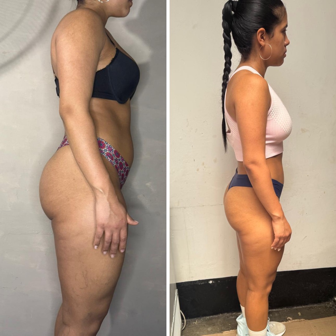 Caso de éxito: antes y después